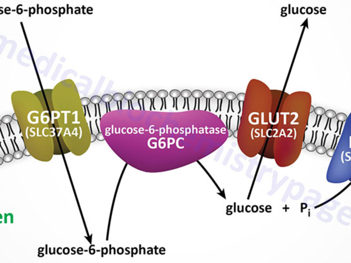 McArdle Disease: Type Glycogen Storage Disease The Medical, 55% OFF