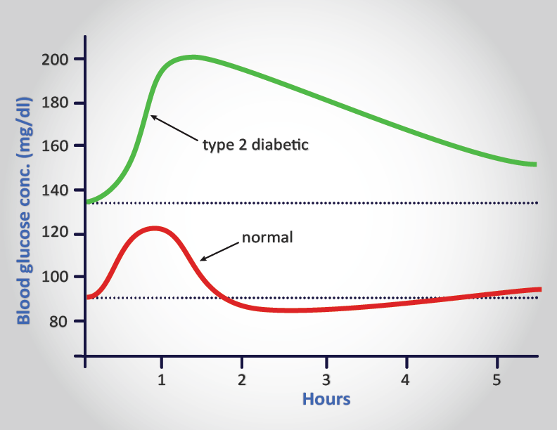 glucose tolerance test type 1 diabetes)