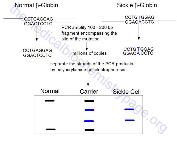Diagrammatic representation of a PCR-SSCP analysis