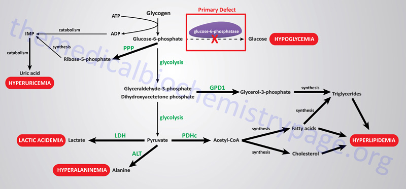 von Gierke Disease: Type 1 Glycogen Storage Disease - The Medical