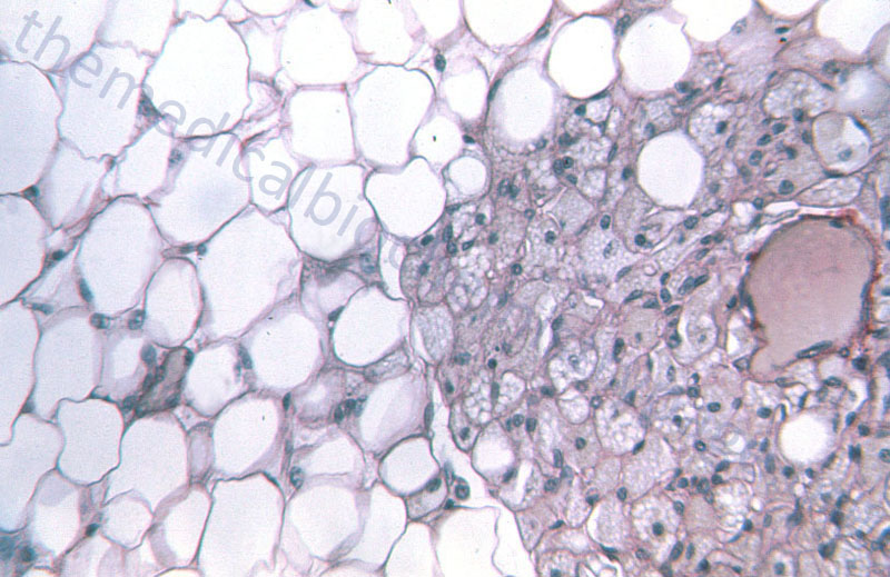 adipose tissue with adipocytes