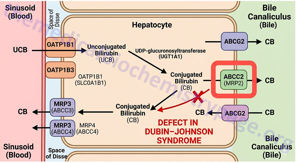 Dubin-Johnson Syndrome