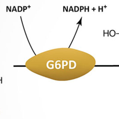 Glucose-6-Phosphate Dehydrogenase (G6PD) Deficiency - The Medical  Biochemistry Page