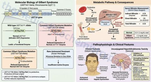 Gilbert Syndrome - The Medical Biochemistry Page