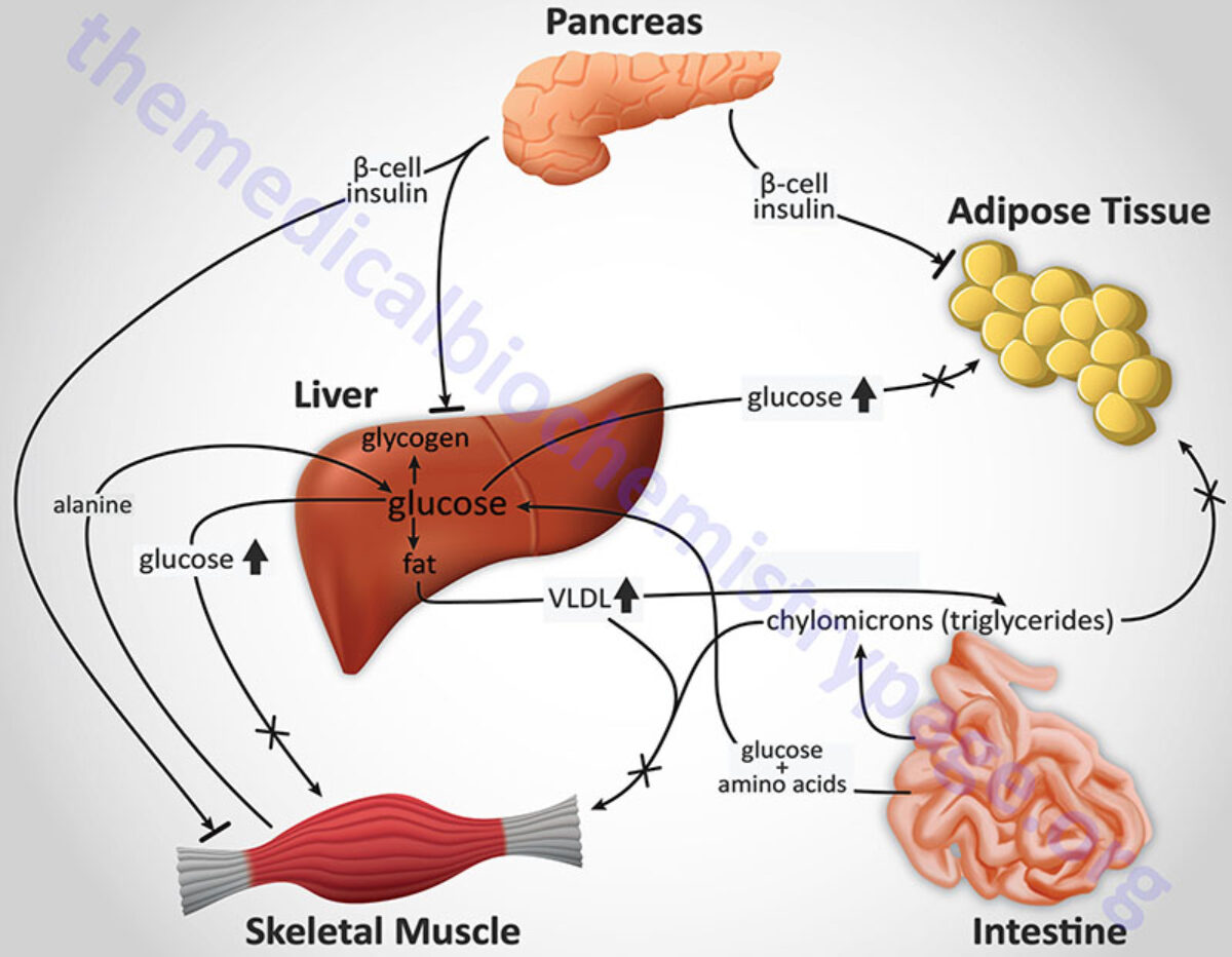 Diabetes Type 200 and Type 20   The Medical Biochemistry Page