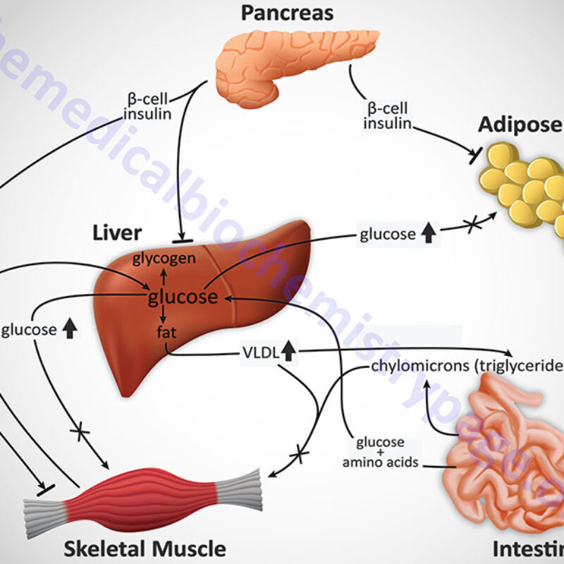 Diabetes Type 1 Type 2: A Comprehensive Guide